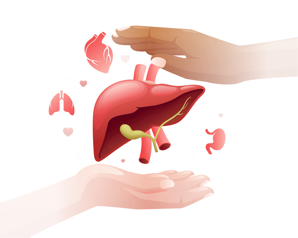 Liver transplant illustration